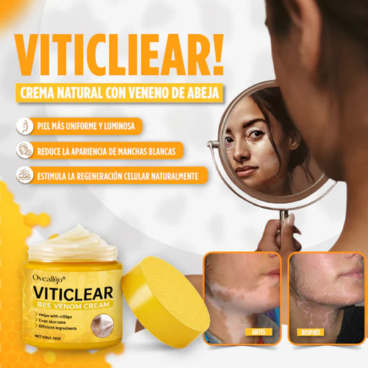Viticlear- Bee Venom Cream